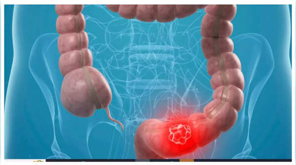 Person experiencing abdominal pain