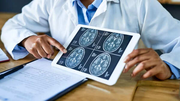 Illustration of a human brain, highlighting the complexity of brain function.